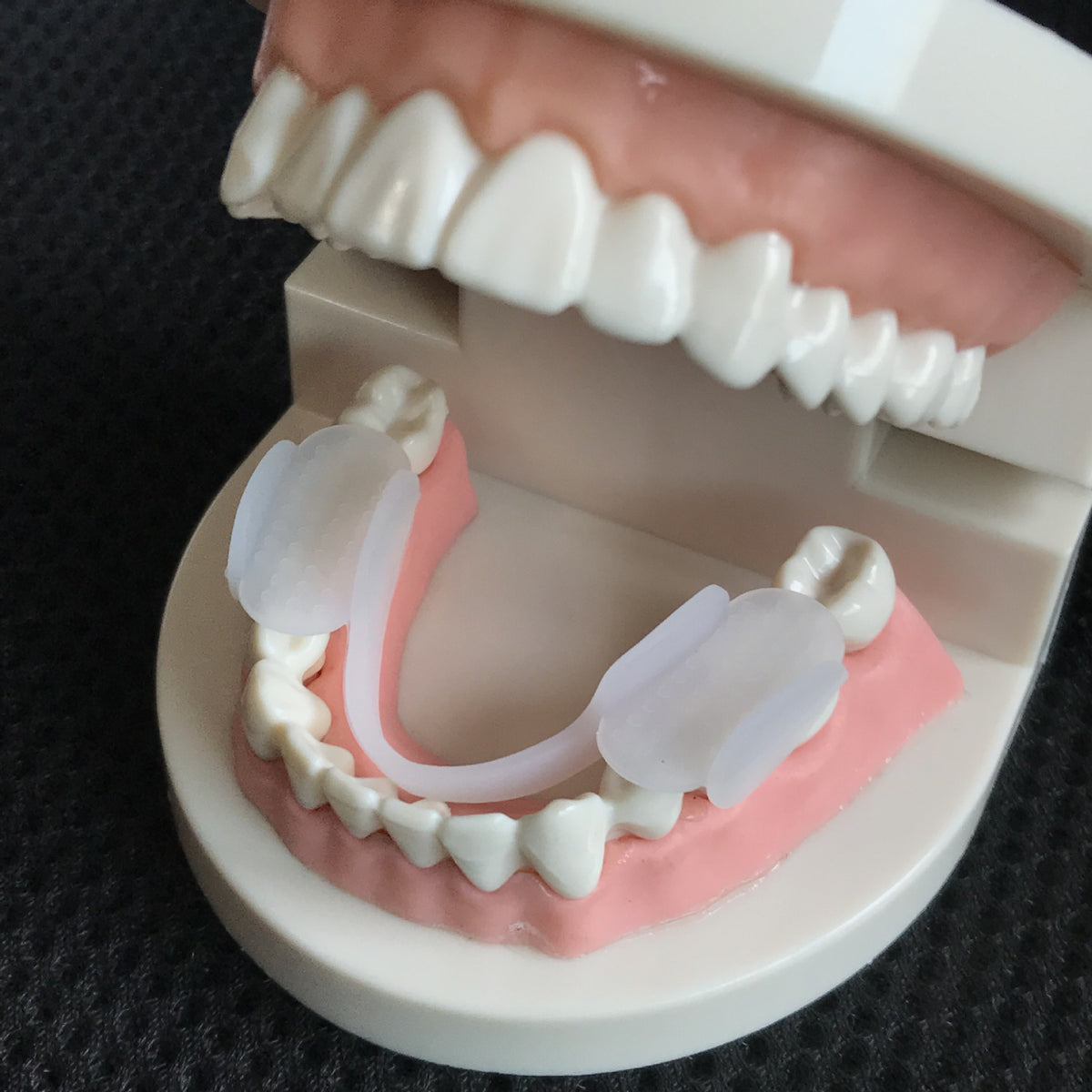 Mouthguard for Teeth Grinding - Nighttime Protection